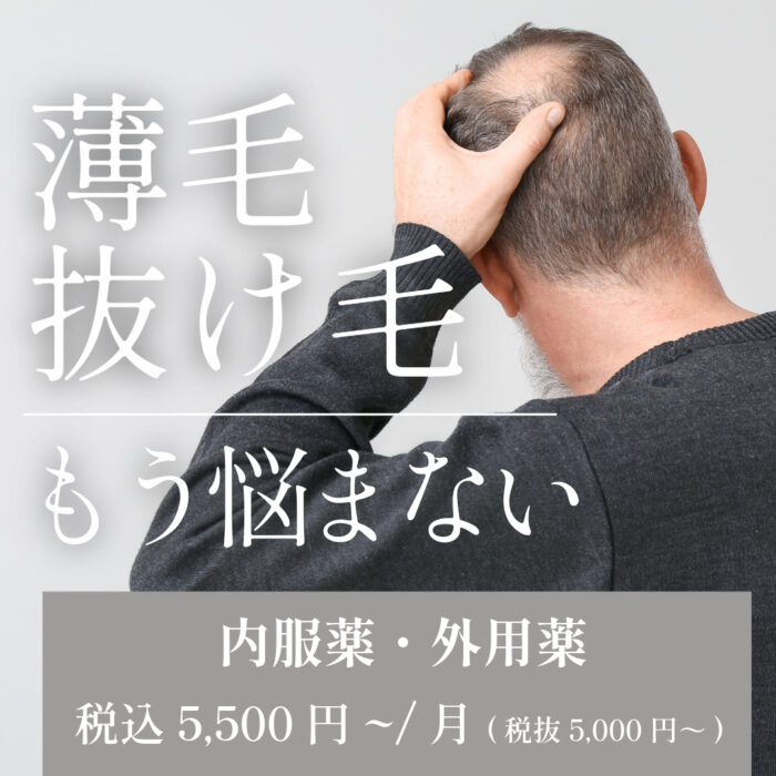 男性AGAーバナー画像